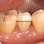 Ortodonzia Preprotesica
